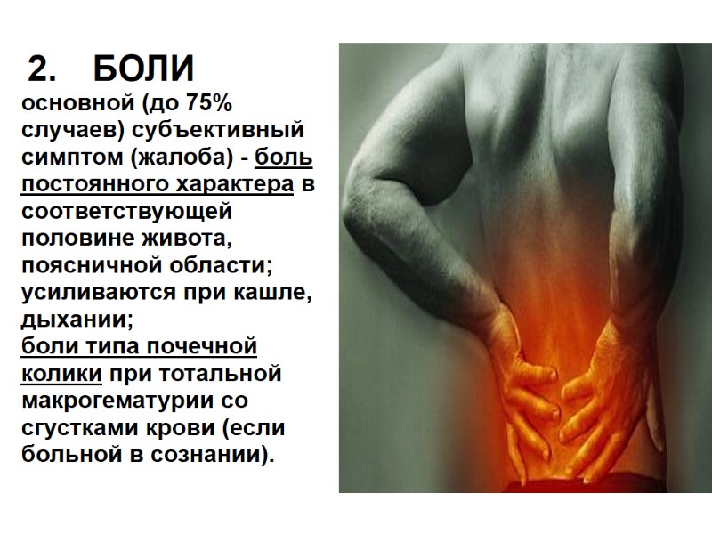2. БОЛИ основной (до 75% случаев) субъективный симптом (жалоба) - боль постоянного характера в